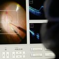 OHSU a leader in eye health care and research
