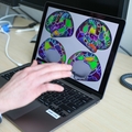 OHSU researchers confirm cumulative, brain-wide effects of ADHD