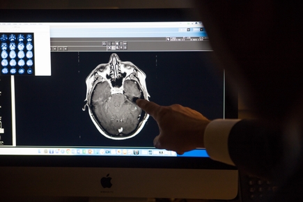 Fentanyl brain research