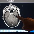 Fentanyl brain research