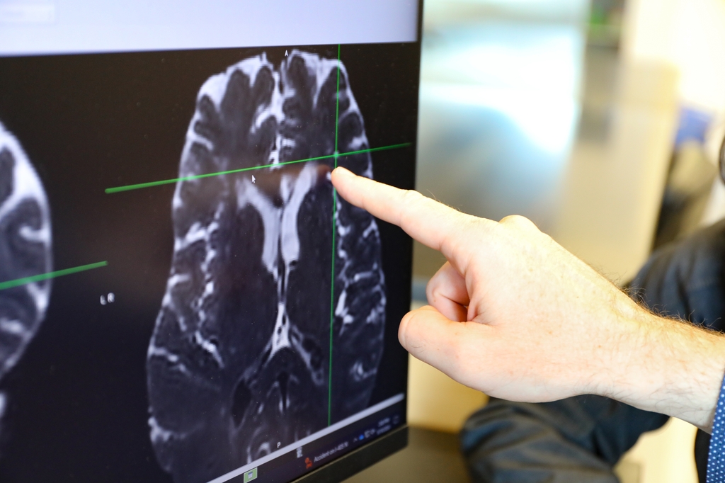 Researching brain cleaning OHSU News