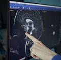 Pediatría del Hospital Infantil Doernbecher - Neurología