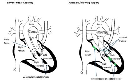 Heart diagram