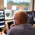 Incisionless brain surgery