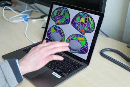 Equipo de investigacion de OHSU efectos generalizados y acumulativos del TDAH en el cerebro 2