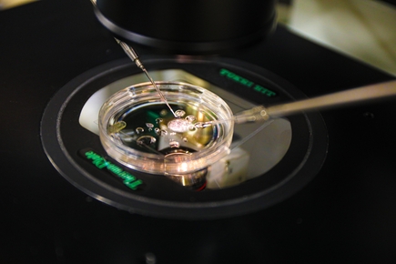 Somatic cell nuclear transfer
