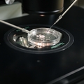 investigación de FIV