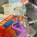 Nuevas combinaciones de fármacos podrían mejorar terapia para cáncer de mama, otros cánceres agresivos