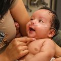 OHSU Doernbecher fetal surgeons perform region’s first in-utero spina bifida repair