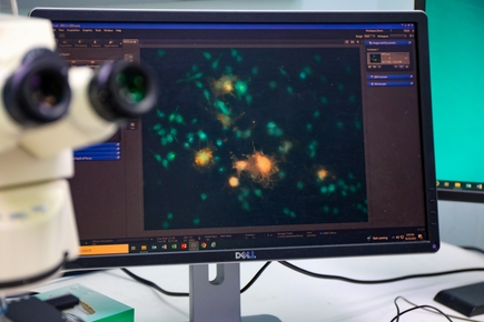 Un compuesto natural encontrado en las flores detiene la progresión de la EM y algunos cánceres