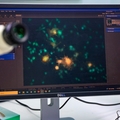 Un compuesto natural encontrado en las flores detiene la progresión de la EM y algunos cánceres