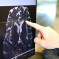 Se revelan por primera vez vías de eliminación de desechos del cerebro