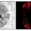 La investigación de Hiroyuki Nakai, M.D., Ph.D.