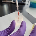 New study identifies how blood vessel dysfunction can worsen chronic disease