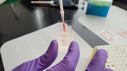Un nuevo estudio identifica cómo las disfunción de vasos sanguíneos puede empeorar enfermedades crónicas