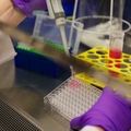 Burwitz lab - studying hepatitis B virus