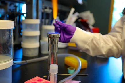 Study: Dangerous E. coli strain blocks gut’s defense mechanism to spread infection