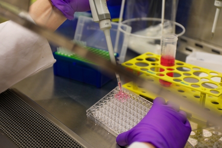 Científicos de OHSU desarrollan el primer modelo transgénico para la investigacion de la hepatitis B
