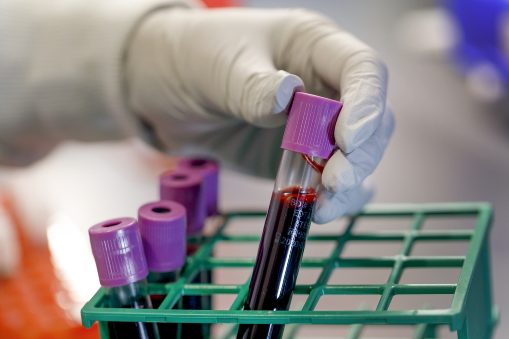 New research reveals a drug developed by scientists at Oregon Health & Science University may develop into a new treatment for an especially aggressive form of breast cancer. (OHSU) Image is a gloved hand grabbing a vile of blood in the Knight Cancer research lab area. New research reveals a drug developed by scientists at Oregon Health & Science University may develop into a new treatment for an especially aggressive form of breast cancer. (OHSU)