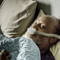 Un estudio revela que la apnea del sueño no tratada aumenta el riesgo de Parkinson
