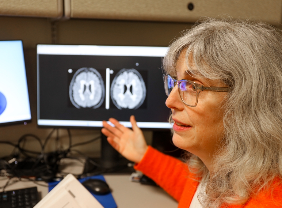 Study: Mixed results in using lipoic acid to treat progressive multiple sclerosis