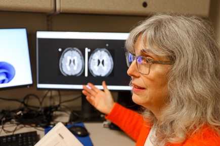 Study: Mixed results in using lipoic acid to treat progressive multiple sclerosis