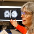 Study: Mixed results in using lipoic acid to treat progressive multiple sclerosis
