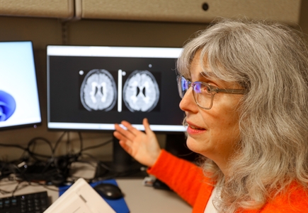 Study: Mixed results in using lipoic acid to treat progressive multiple sclerosis