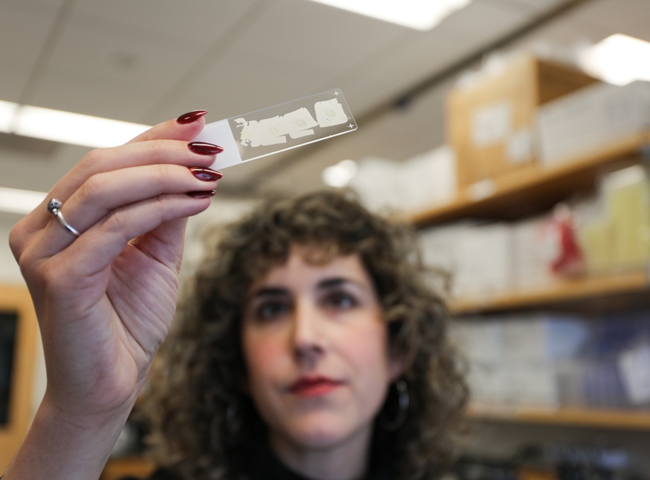 Researchers identify kidney sensor that helps control fluid balance
