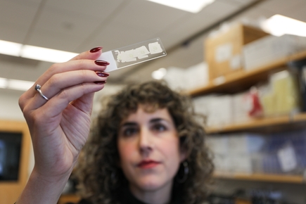 Researchers identify kidney sensor that helps control fluid balance