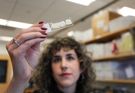 Researchers identify kidney sensor that helps control fluid balance