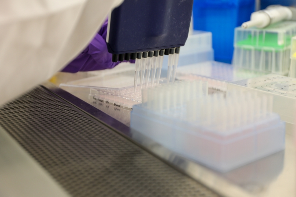 Investigadores de Oregon Health & Science University han identificado un gen que podría dificultar la eficacia de la vacuna contra el VIH en humanos, allanando el camino para un mejor desarrollo de vacunas contra el VIH y otras enfermedades como el cáncer y la malaria. (OHSU/Christine Torres Hicks)
