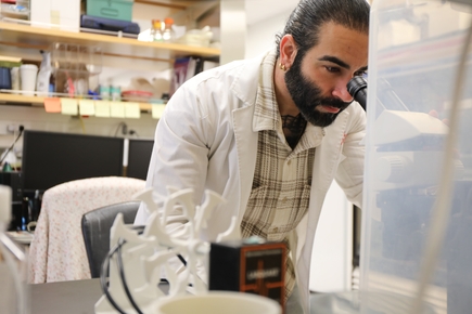 Glaucoma progression study