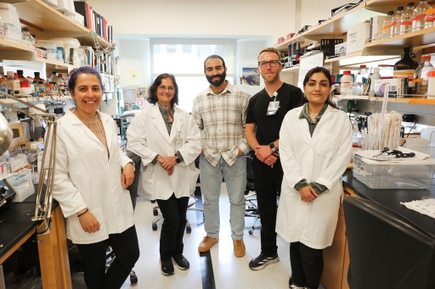 el estudio del glaucoma 2