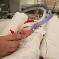 Terapia con CPAP en la UCIN