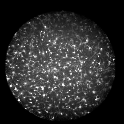 Astrocytes video