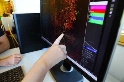 Investigadores de OHSU descubren vínculo entre proteína clave y el desarrollo de las sinapsis cerebrales