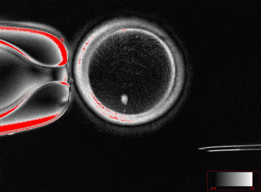 Investigadores de OHSU han demostrado una nueva técnica para tratar la infertilidad al convertir las células de la piel en ovocitos u óvulos. Aquí se muestra una imagen de un ovocito con una imagen brillante de un núcleo de células de la piel antes de la fertilización. (Oregon Health & Science University)