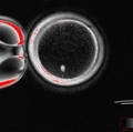 A new technique to treat infertility