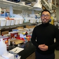 Un proyecto busca desarrollar un método de detección de Alzheimer mediante prueba de la retina