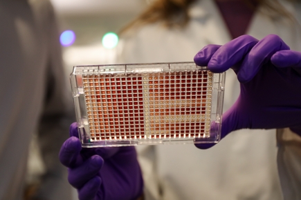 Investigadores de OHSU descubren que un medicamento contra el cáncer de mama potencia el tratamiento para la leucemia