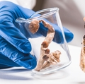 Iniciativa de investigación liderada por OHSU examina el uso supervisado de psilocibina