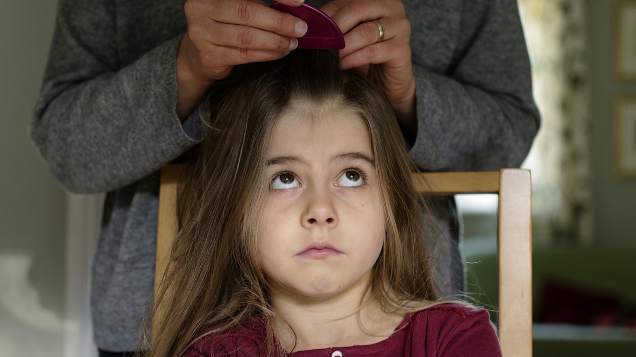 Heading Off Lice Novant Health Healthy Headlines