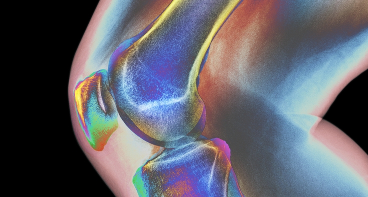 Referring patients for ACL injuries? Here’s what to expect with diagnostics, treatment options and prehab.