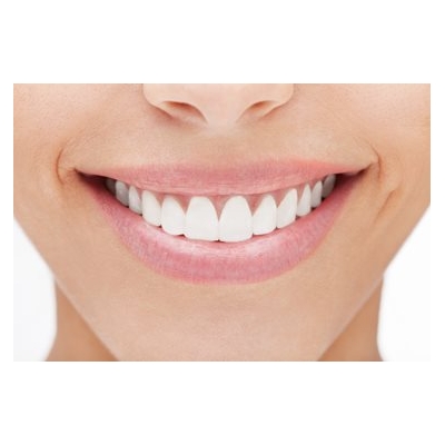 Diy Teeth Whitening Too Good To Be True Urmc Newsroom