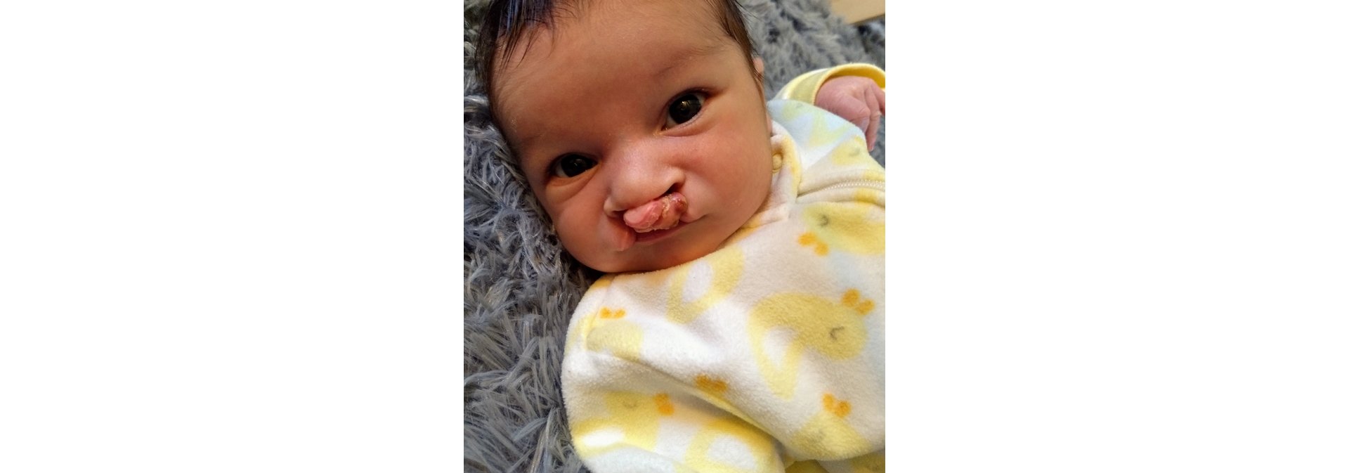 Drive By Dentistry During Covid 19 Helps Infant Urmc Newsroom