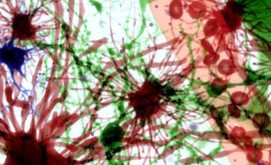 Research to Treat Neurodegenerative Diseases Advances: URMC Start-up Acquired