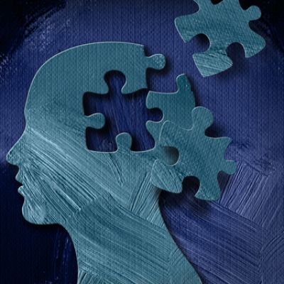 What we know about aducanumab – the new FDA approved drug to treat Alzheimer’s disease