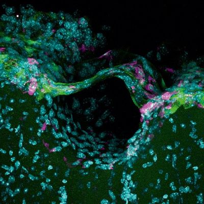 Newly Discovered Anatomy Shields and Monitors Brain