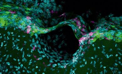 Newly Discovered Anatomy Shields and Monitors Brain